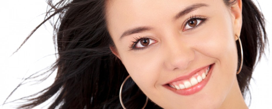 Smiling Young woman with compost bondings or tooth colored dental bondings
